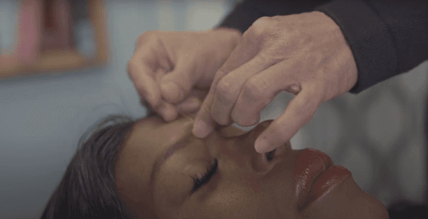 Acupuncture for Balanced Wellness