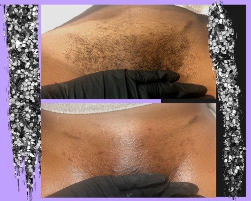 Brazilian Wax