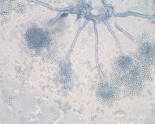 Aspergillus