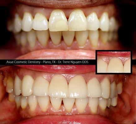 Avue Cosmetic Dentistry