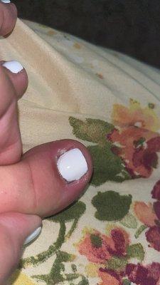 Infected toe, before it got too bad