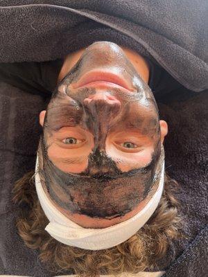 Charcoal Mask, great for acneic and oily skin