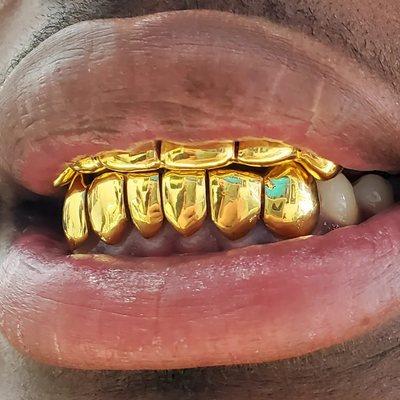 24 Karat Gold over silver Grillz Special Price Fast Turnaround!