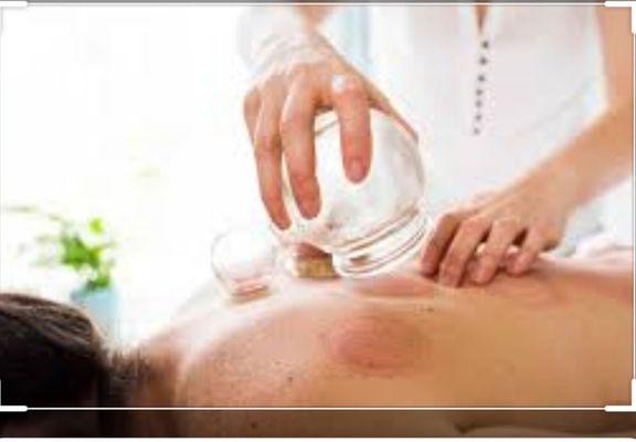 We offer cupping! Helps to decrease pain and increase circulation.