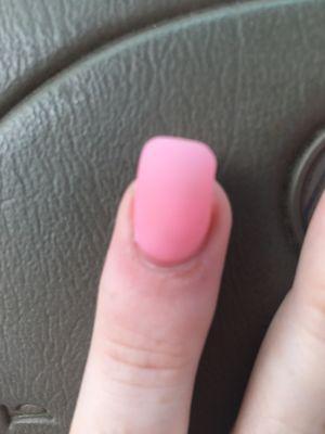 Under my cuticle is almost bruised!