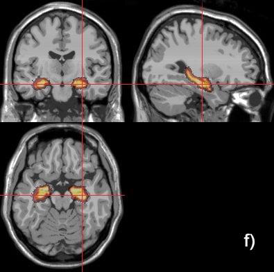 Westside Medical Imaging