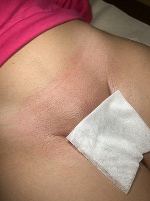 Brazilian wax