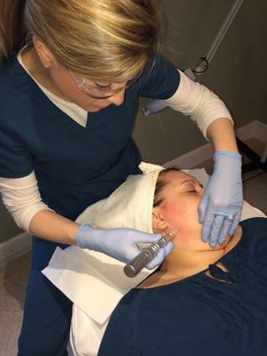 Microneedling - the latest breakthrough in age management!