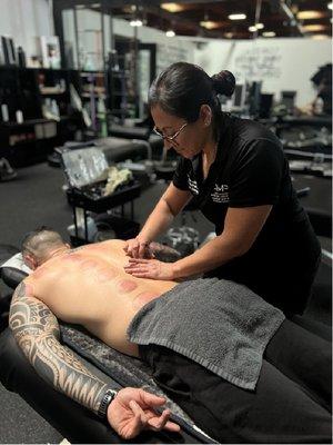 AMP Specialist Veronica Jacquez in AMP Temecula location. Cupping Therapy and Myofasical Release Technique.