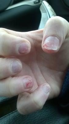 destroyed my nails