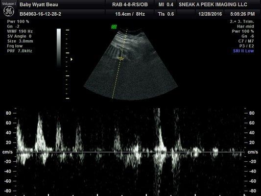 Gender Check Houston Tx, 2D Ultrasound in Houston