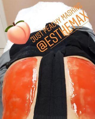 Just Peachy- buttocks microdermabrasian and hydrojelly mask