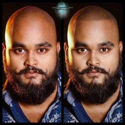 Impressions Scalp Micropigmentation