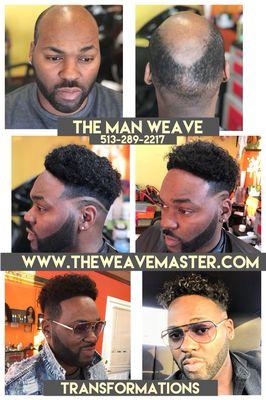 The man Weave hair replacement