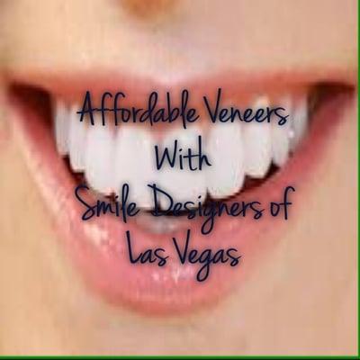 Affordable Veneers