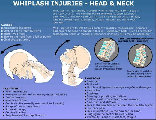 Experiencing whiplash?
I can help