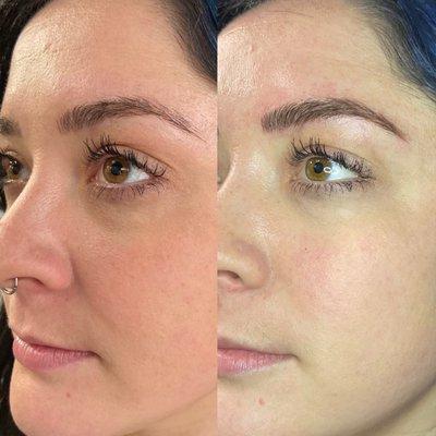 Microblading-6 week touch up