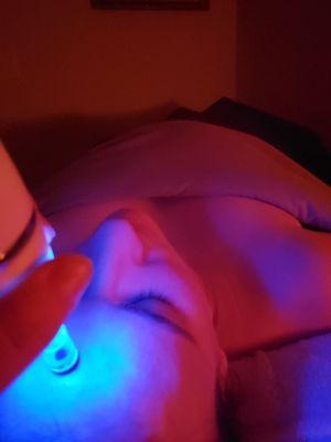 Microdermabrasion treatment