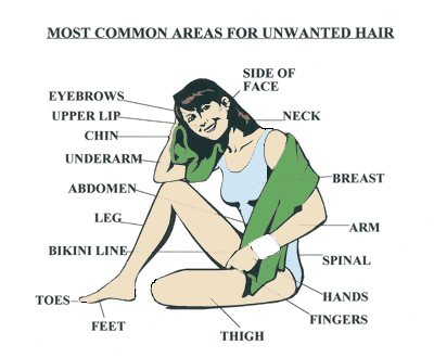 Most Common Areas for Unwanted Hair in Women