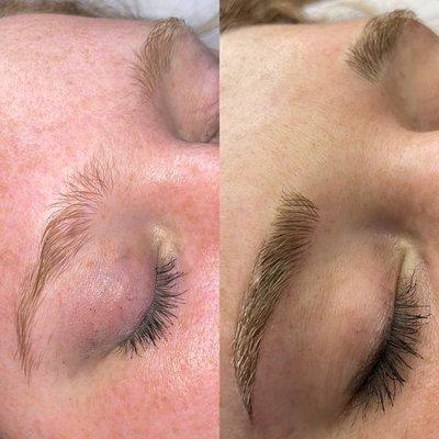 Microblading