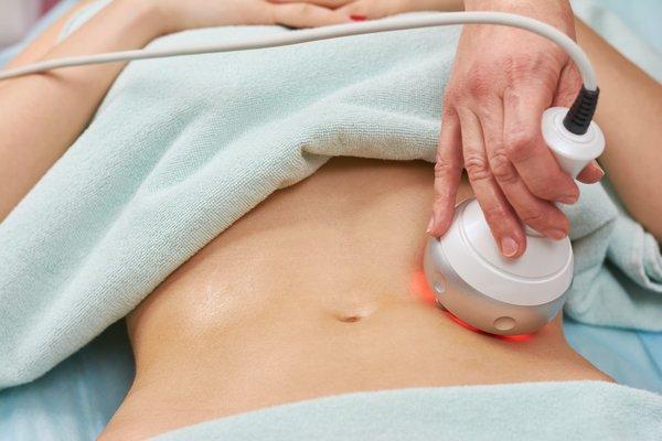 Radiofrequency Body Treatment