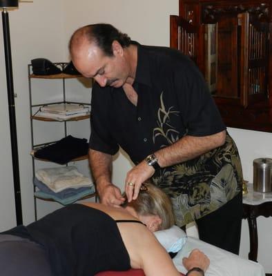 Acupuncture for Pain Relief