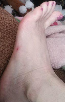 Pedicure cut on side of my foot!