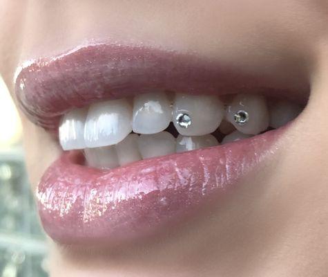 Tooth Gems