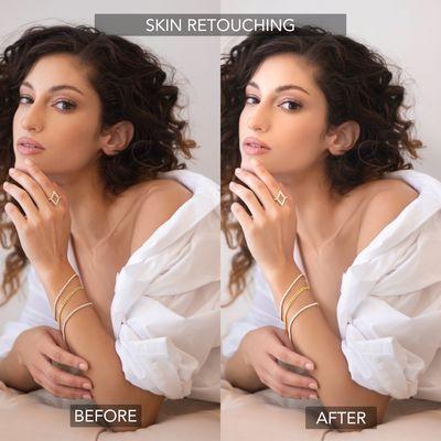 Try out our retouching service. Skin/Beauty retouching.