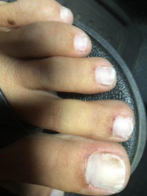 My cuticles have been sore now for 2 days . My toenails are ruined for awhile now . Absolutely ridiculous. They should be shut down