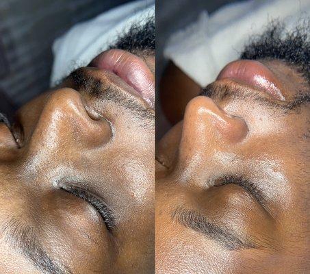 Gentlemen's Facial