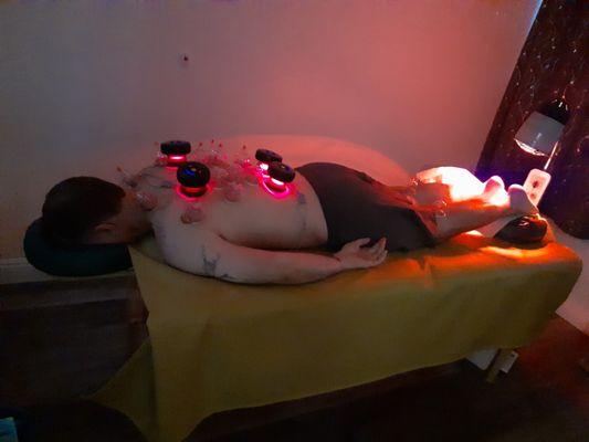 Infrared cupping therapy that relieves pain and promote blood flow