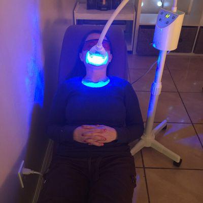 Led Teeth Whitening