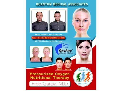 Quantum Healing Beverly Hills Office Hair restoration and Non surgical Mini - Facelift ( stem - cells)