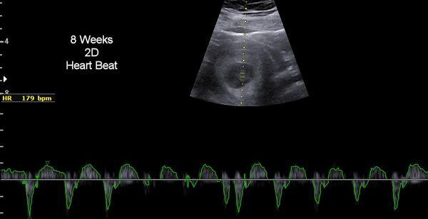 8 Week Heart Beat