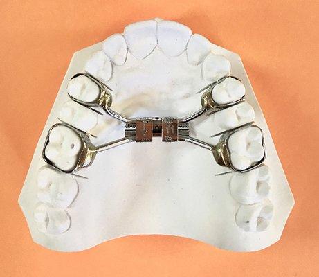 Summit Orthodontic Services