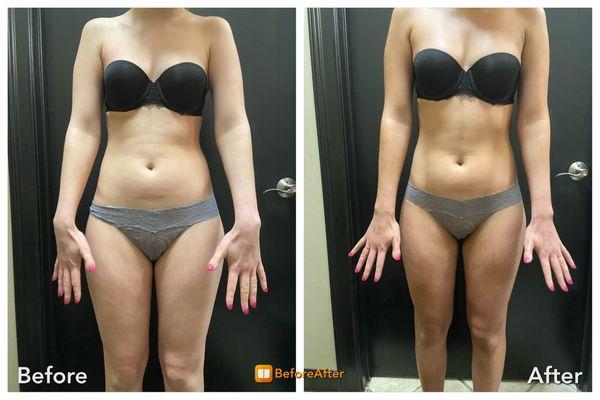 Before n After Airbrush tan, body contouring (six pack enhancement)