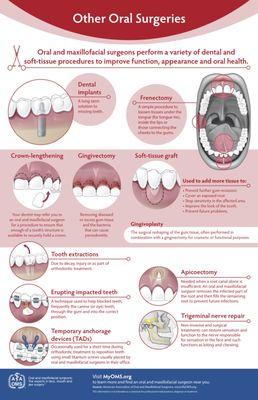 Extraction surgeries