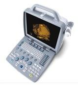 SIUI portable Ultrasound machine