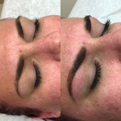 Brow transformation.