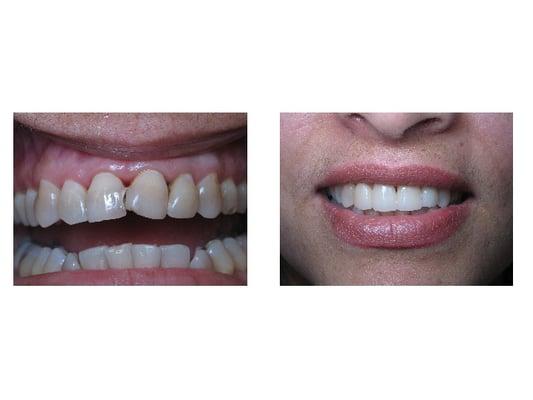 Cosmetic Dentistry