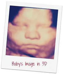 Baby's Image in 3D