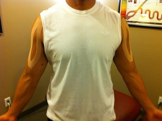 Athletic taping of shoulders