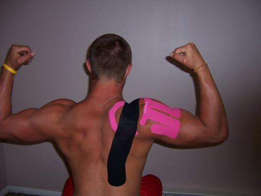 Shoulder Kinesiology taping