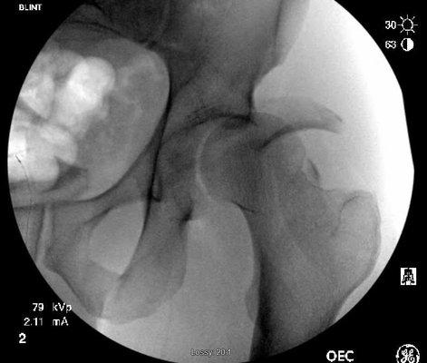 NITROrthopaedics Northern Illinois Trauma Regional Orthopaedics