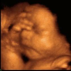 My 3D ultrasound memories