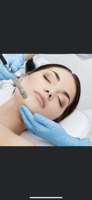 Microdermabrasion