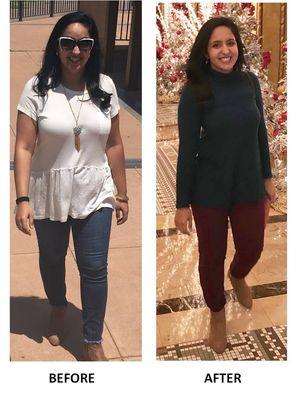 Real patient before/after 20 lbs lost