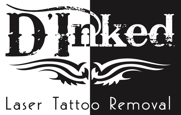 D Inked Laser Tattoo Removal