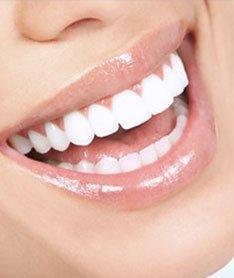 Teeth Whitening in Midtown NYC - Dr. Alex Rubinov